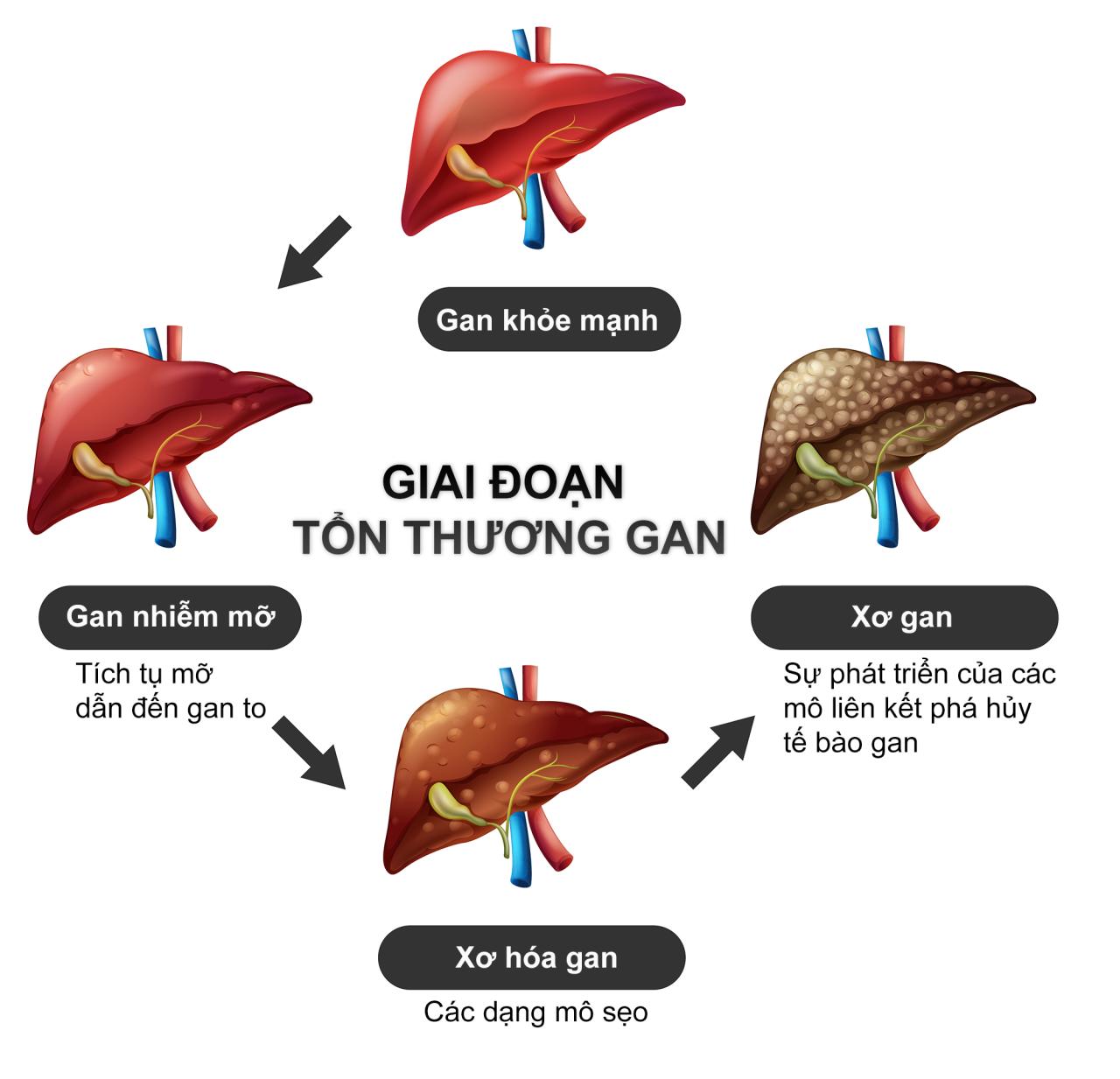 Viêm Gan B: Nguy Hiểm, Biến Chứng và Giải Pháp Hỗ Trợ Tự Nhiên Từ DLC Care Dĩ An